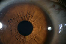 Sanguine Constitution